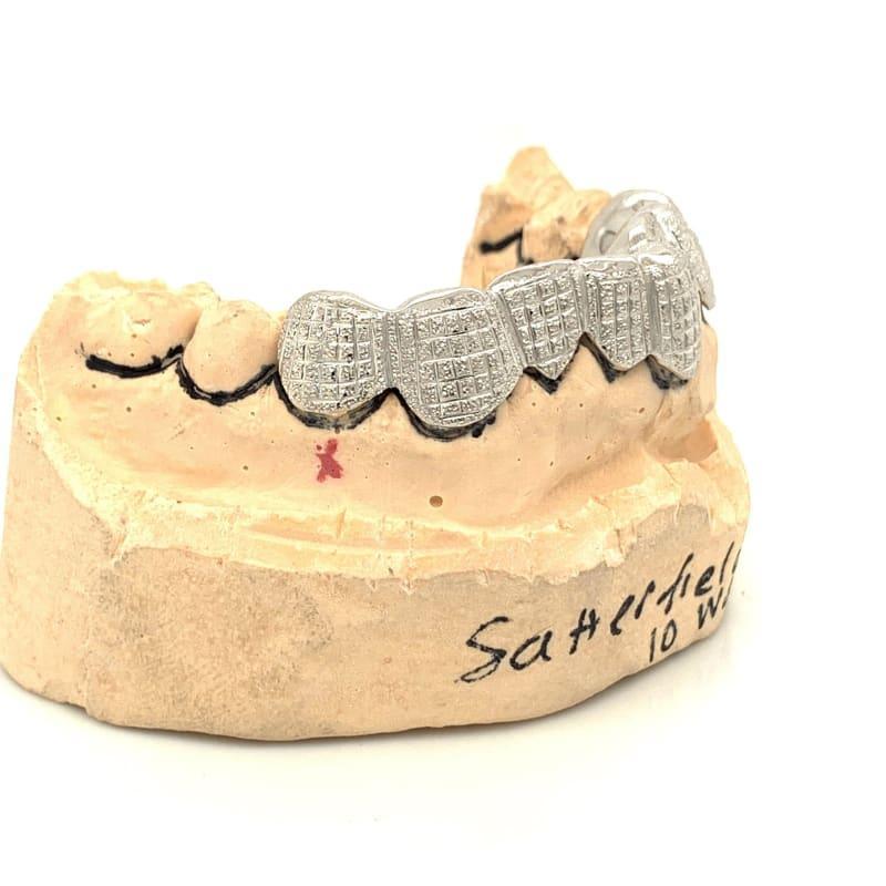 8pc White Gold Dusted Bricks Grillz - Seattle Gold Grillz