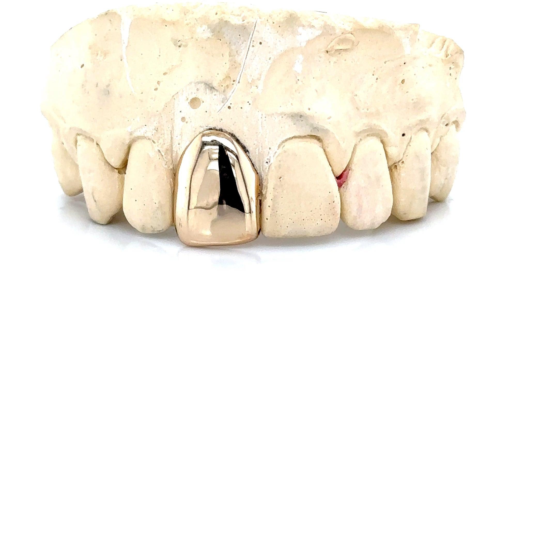 1pc Gold Front Tooth Grillz
