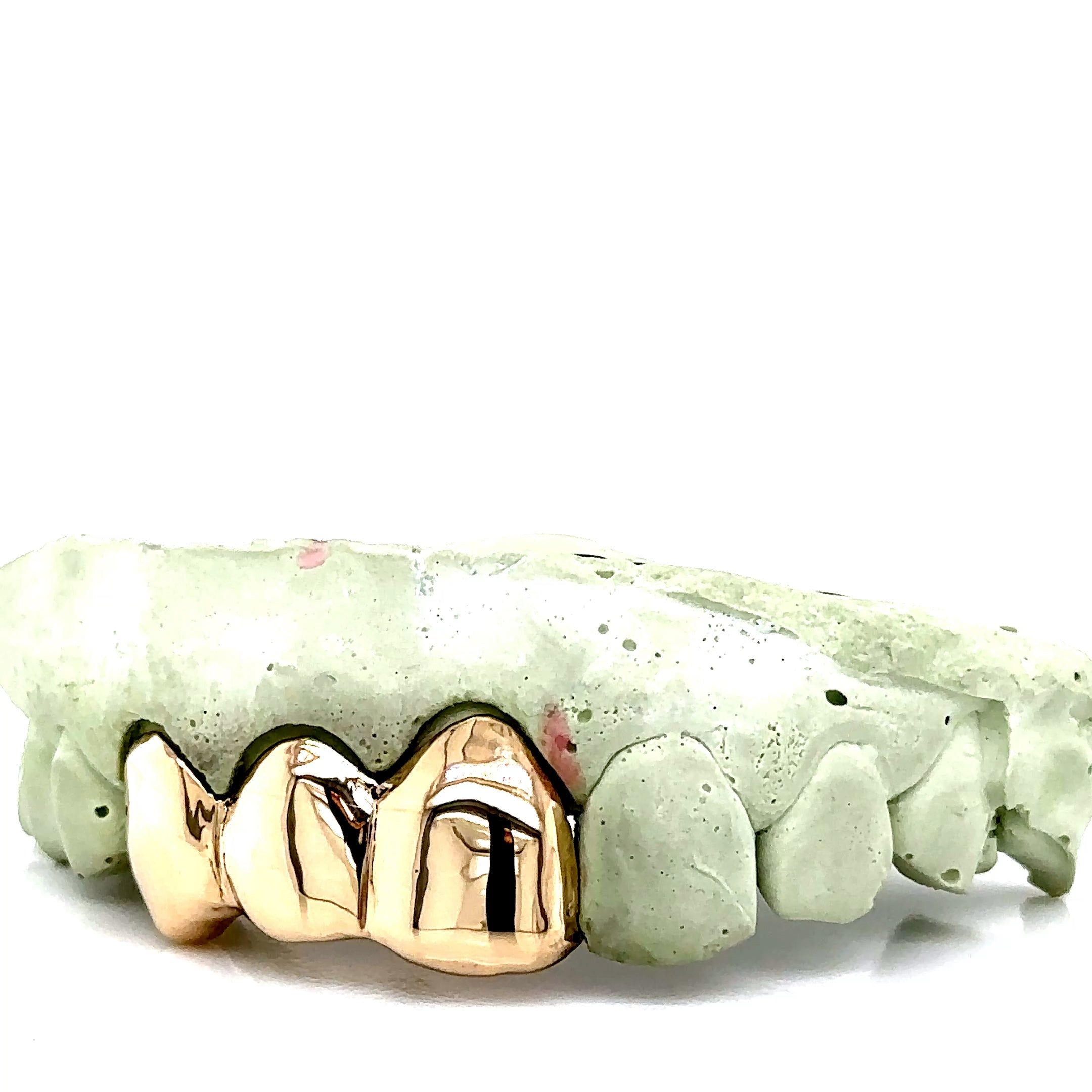 3pc Gold Top Grillz