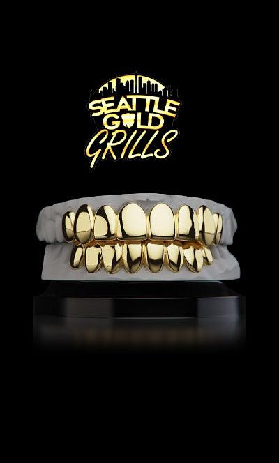 gold-teeth_2 - Seattle Gold Grillz
