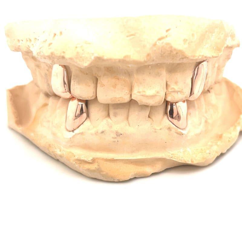 Rose Gold Fang Grillz Set - Seattle Gold Grillz