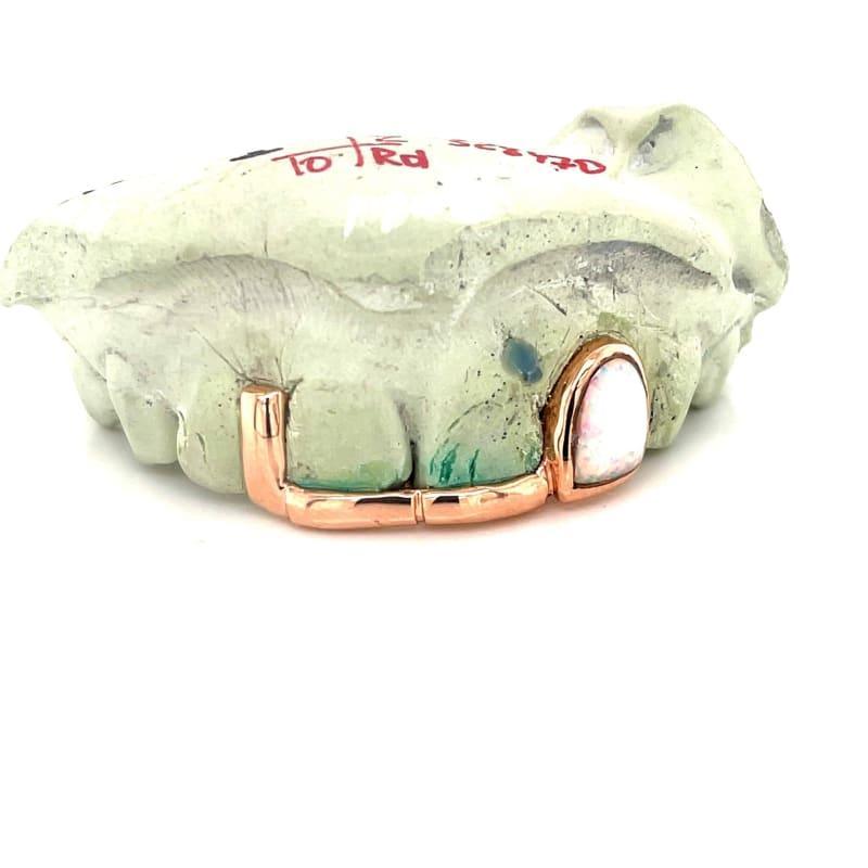 Rose Gold Gap Opal Grillz - Seattle Gold Grillz