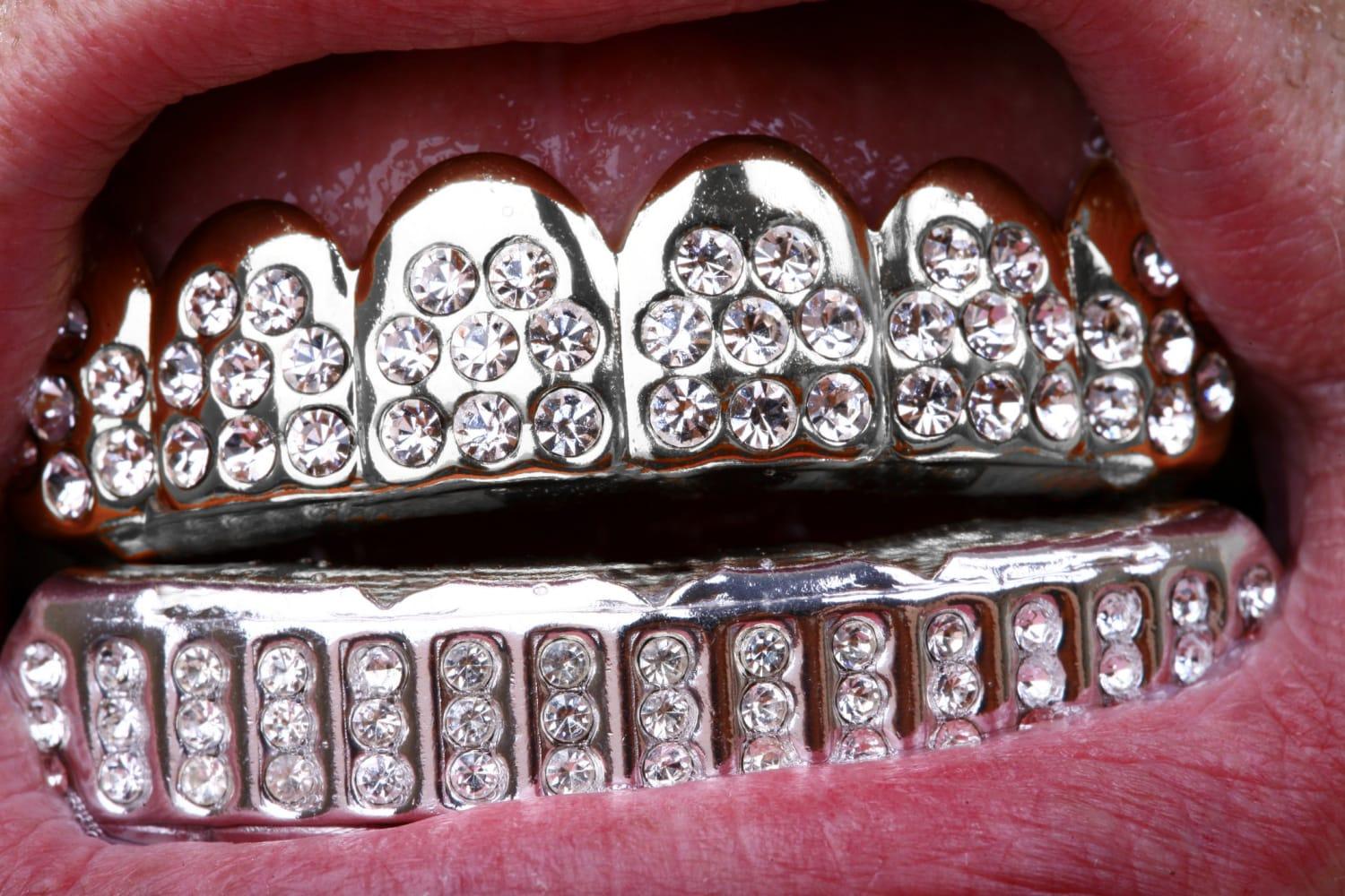 TYPES OF GRILLZ: WHAT ARE THEIR DIFFERENCES? - Seattle Gold Grillz