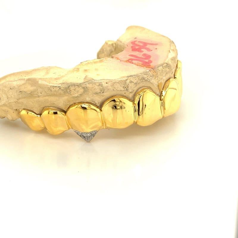 10pc Gold Ice Tip Fang Top Grillz - Seattle Gold Grillz