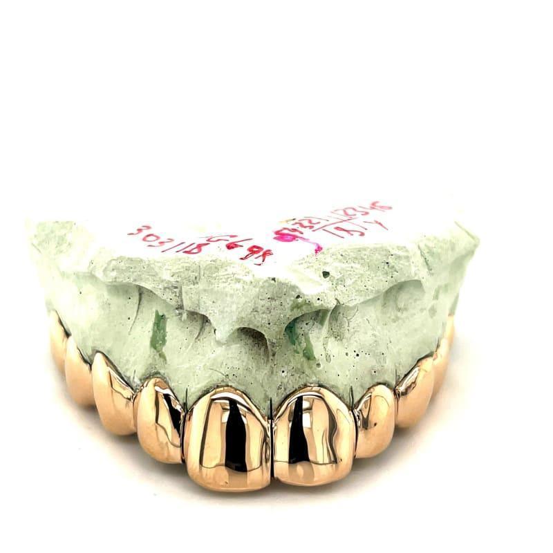10pc Gold Perm Cut Grillz - Seattle Gold Grillz