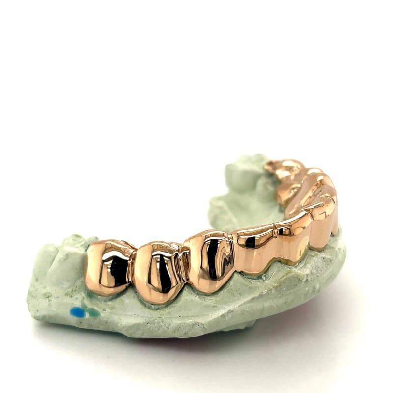 10pc Gold Perm Cut Grillz - Seattle Gold Grillz