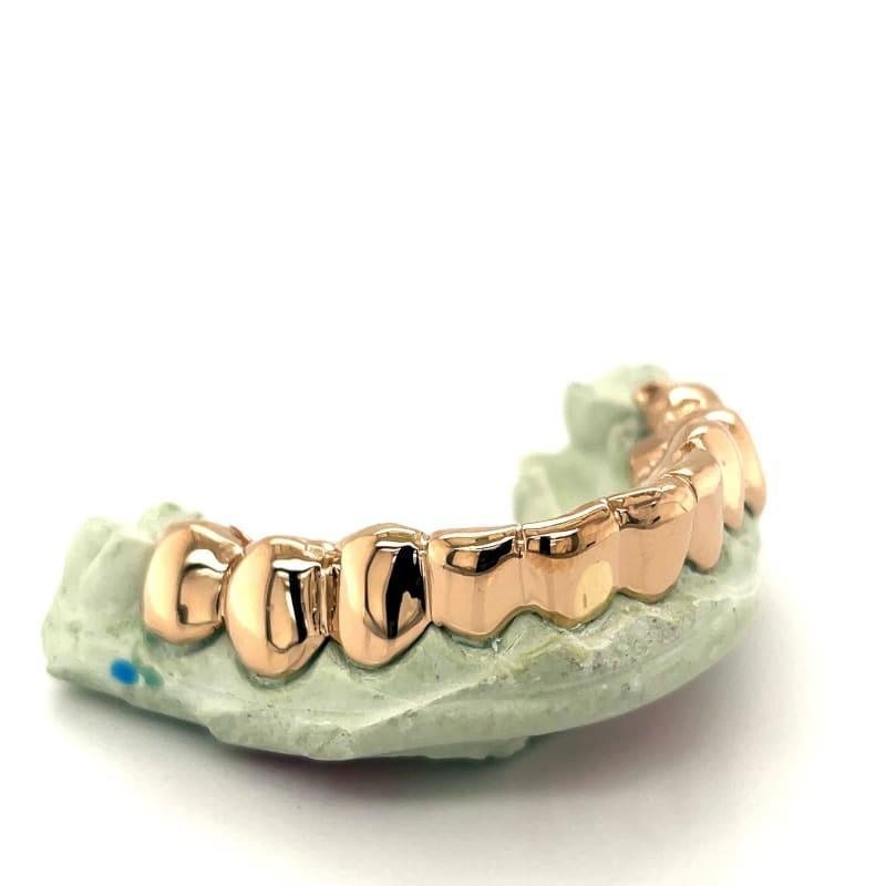 10pc Gold Perm Cut Grillz - Seattle Gold Grillz
