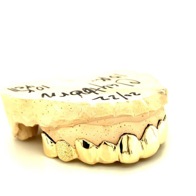 10pc Gold Snowflake Grillz - Seattle Gold Grillz