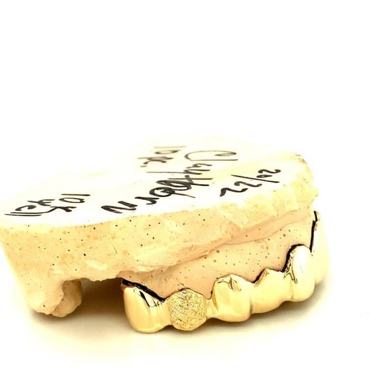 10pc Gold Snowflake Grillz - Seattle Gold Grillz