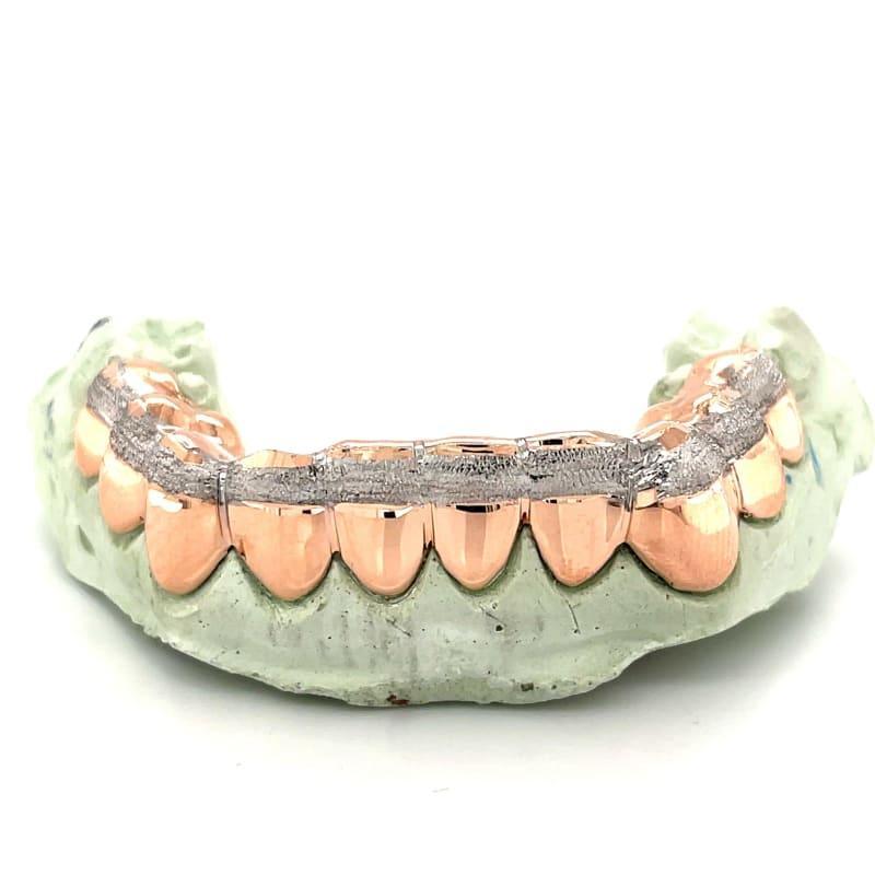 10pc Rose Gold Dusted Grillz - Seattle Gold Grillz