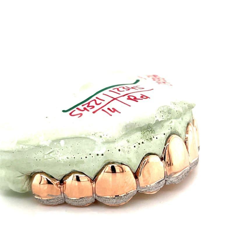 10pc Rose Gold Dusted Grillz - Seattle Gold Grillz