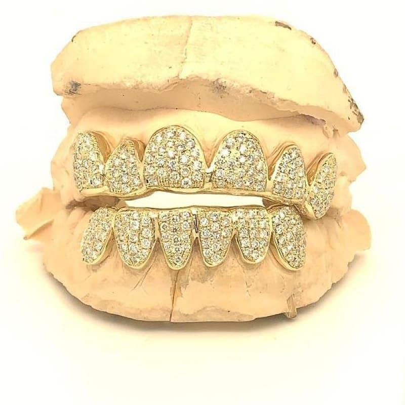 12pc Box Set Diamond Grillz - Seattle Gold Grillz