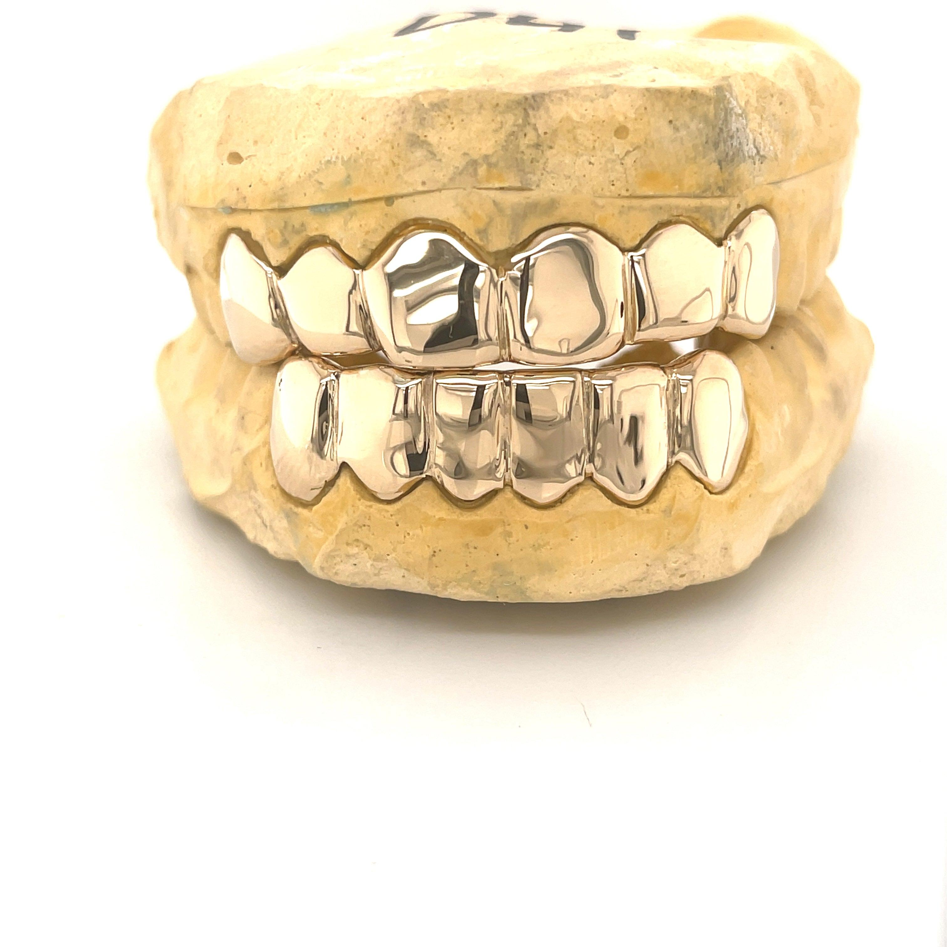 12pc Gold High Polished Grillz - Seattle Gold Grillz