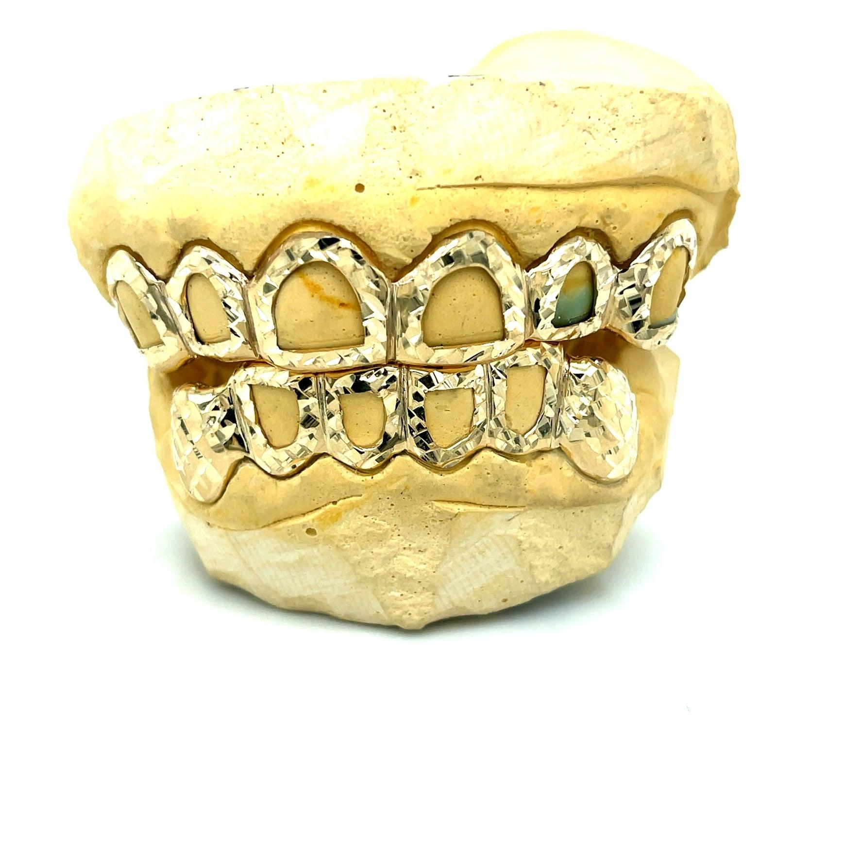 12pc Gold Open Trillion Cut Grillz - Seattle Gold Grillz