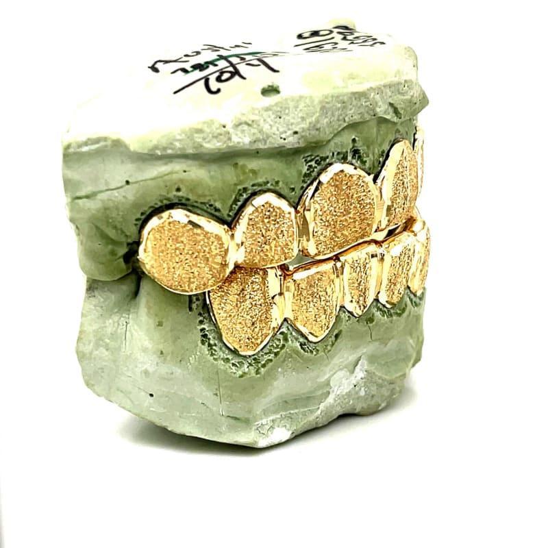 12pc Gold Polished Dust Grillz - Seattle Gold Grillz