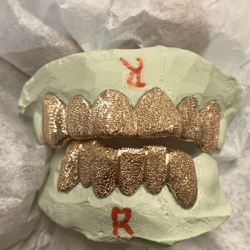 12pc Rose Gold Dust Grillz - Seattle Gold Grillz