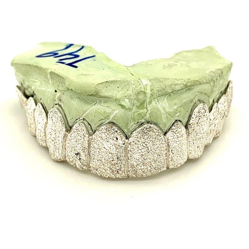 12pc Silver Diamond Dust Top Grillz - Seattle Gold Grillz