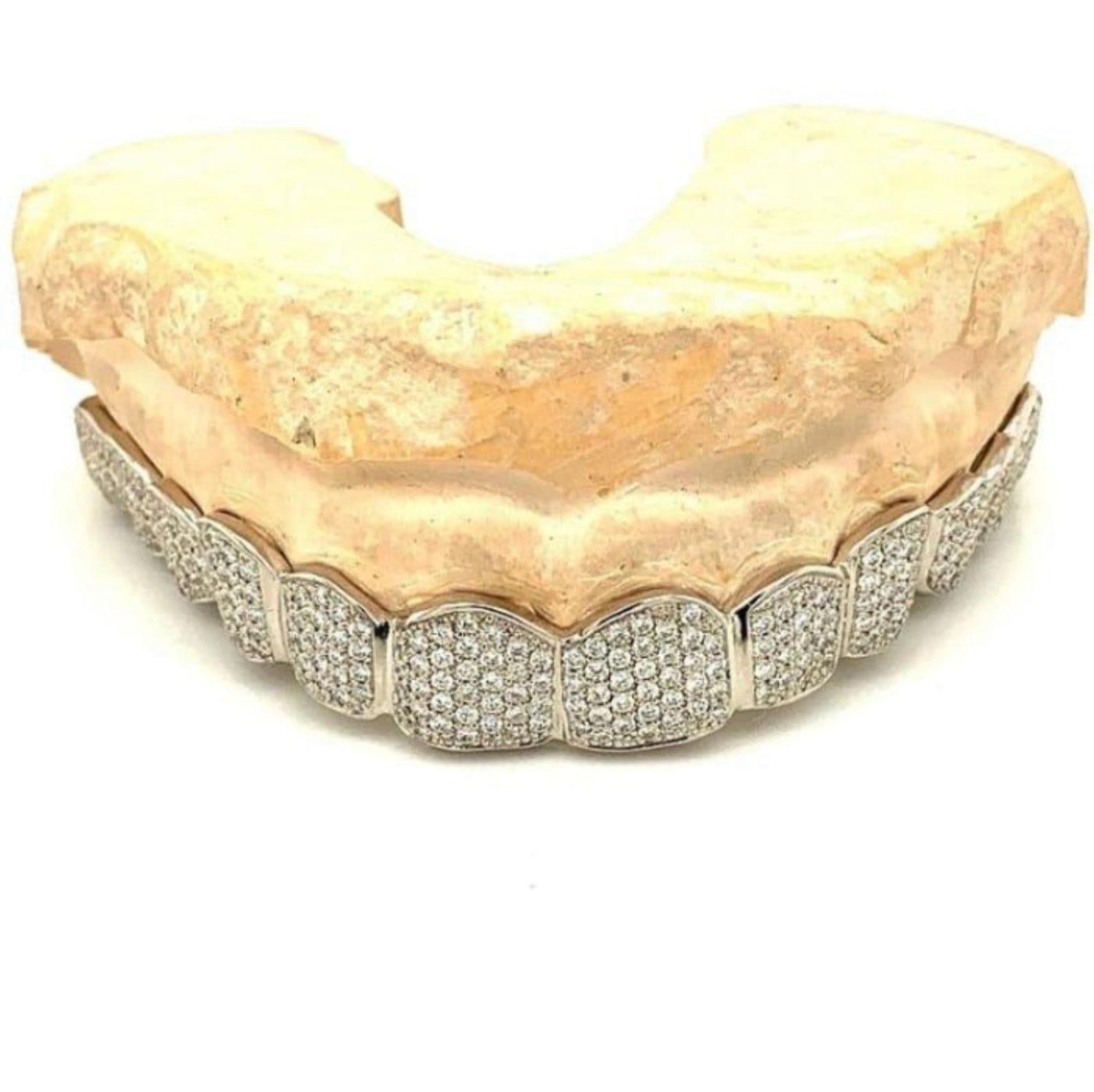 12pc White Gold Diamond Top Grillz - Seattle Gold Grillz