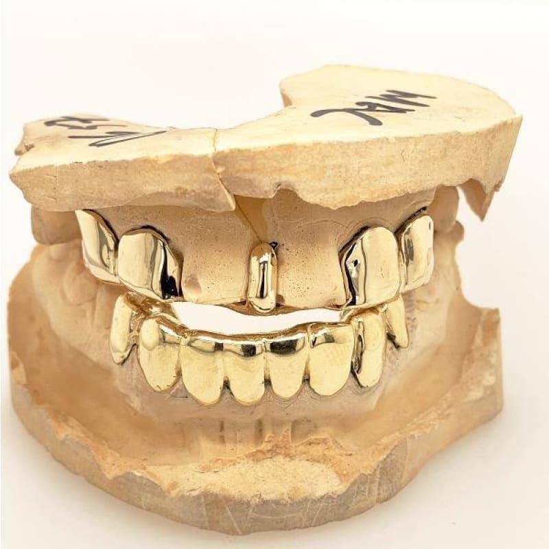 14pc Gold Gap Tooth Grillz - Seattle Gold Grillz