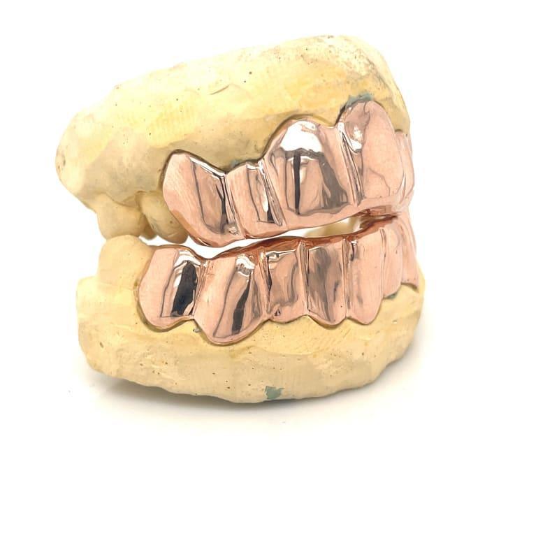 14pc Rose Gold Grillz - Seattle Gold Grillz