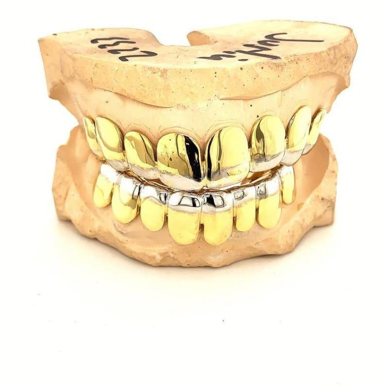 16pc Gold French Tipped Grillz - Seattle Gold Grillz