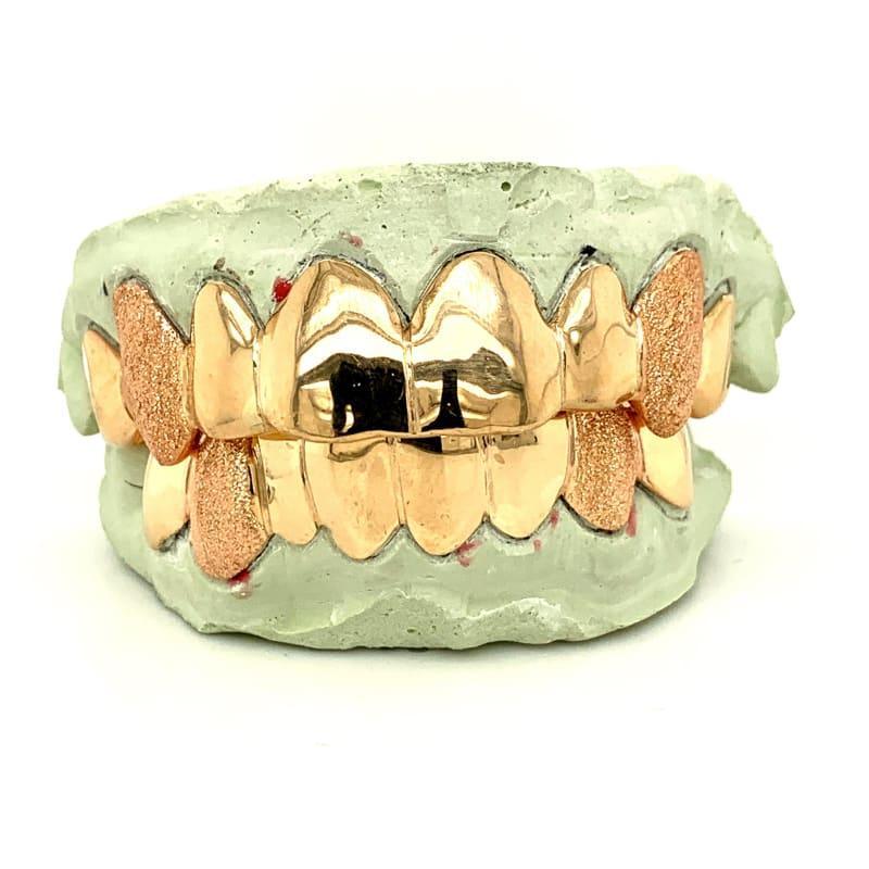 16pc Rose Gold Dusted Fangs Grillz - Seattle Gold Grillz