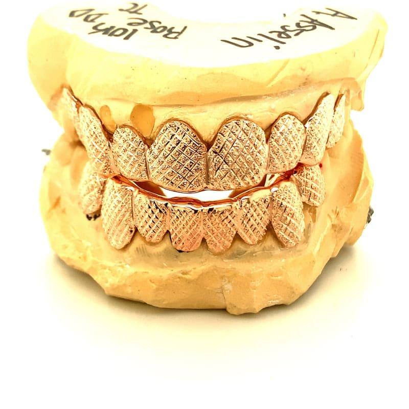 16pc Rose Gold Snowflake Grillz - Seattle Gold Grillz