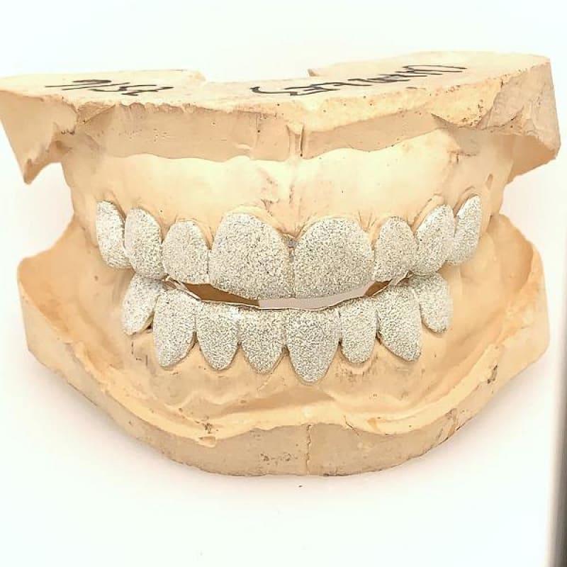 16pc Silver Diamond Dust Grillz Set - Seattle Gold Grillz