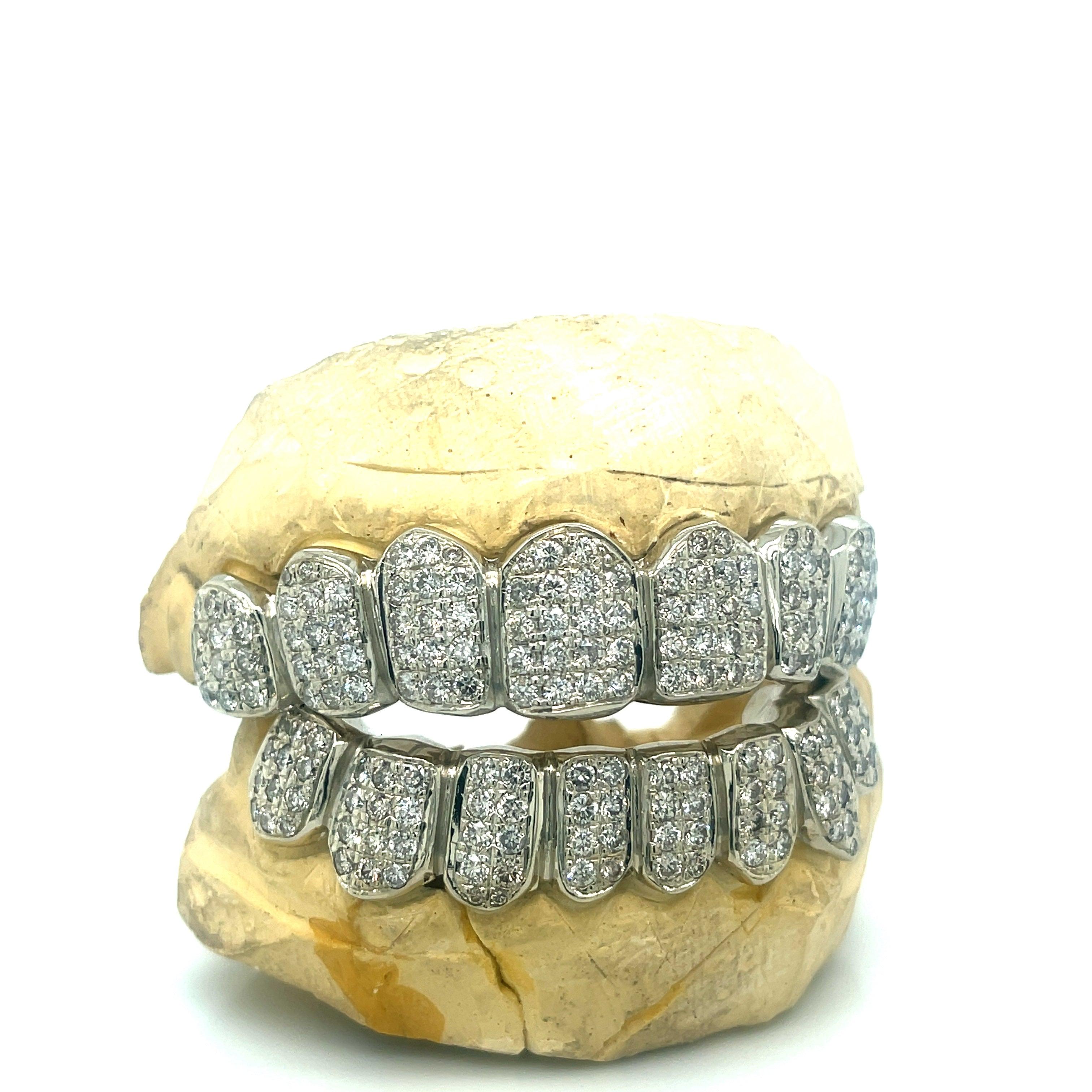 16pc White Gold Box Set Grillz - Seattle Gold Grillz