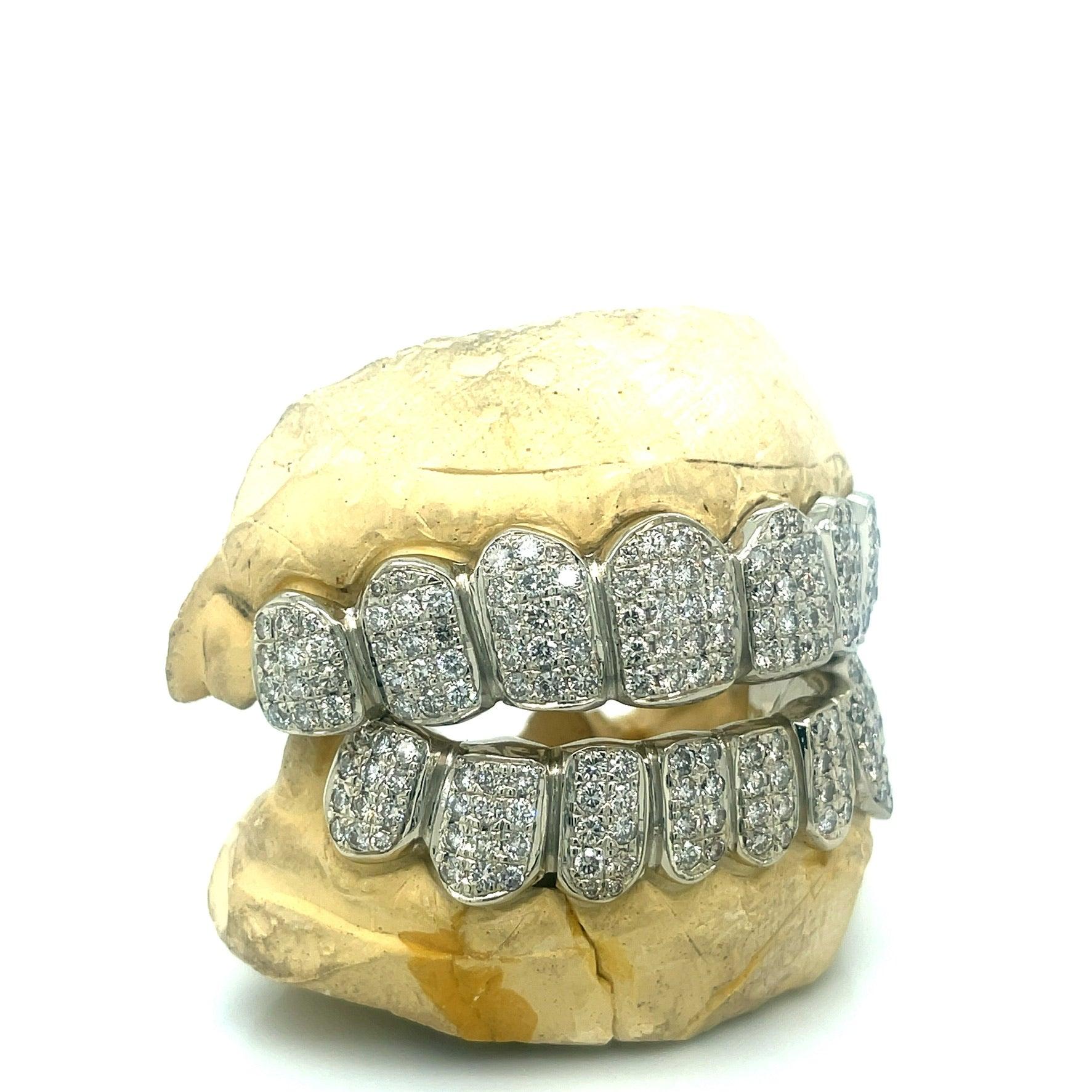 16pc White Gold Box Set Grillz - Seattle Gold Grillz