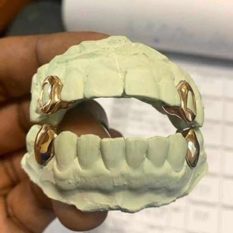 2 Top 2 Bottom Gold Grillz - Seattle Gold Grillz