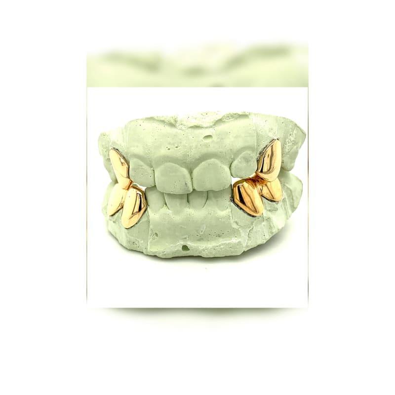 2 Top 4 Bottom Gold Grillz - Seattle Gold Grillz