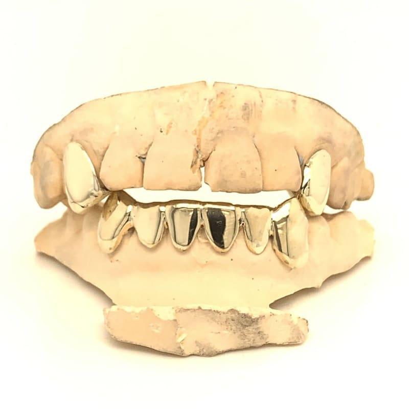 2 Top 6 Bottom Gold Grillz - Seattle Gold Grillz