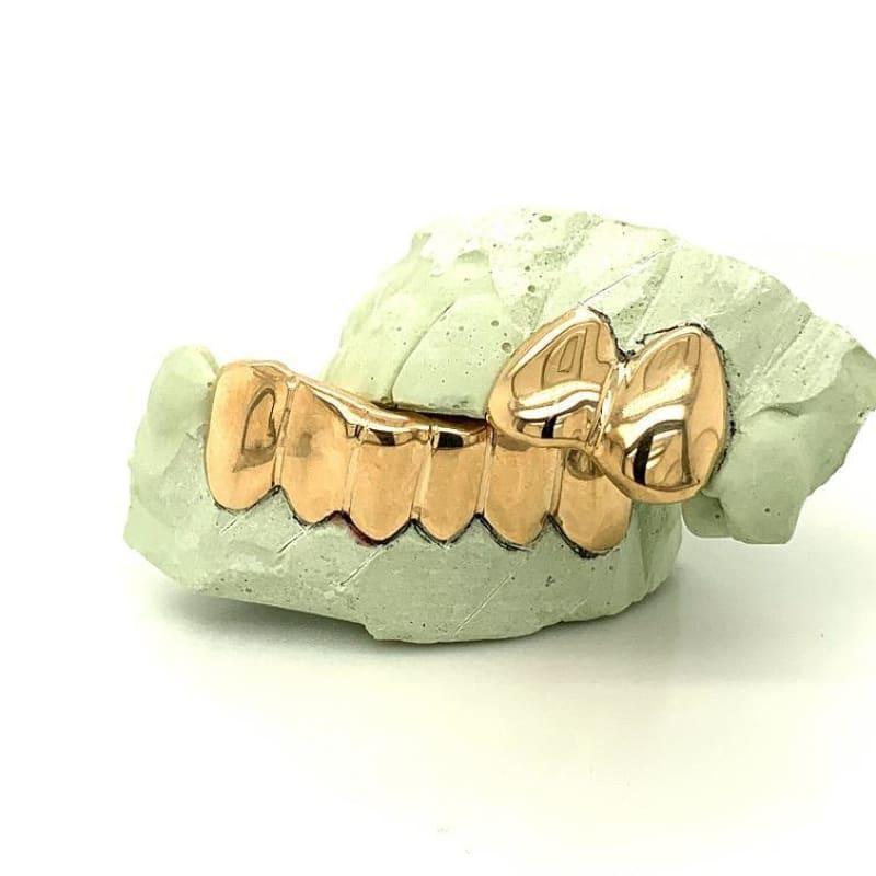 2 Top 6 Bottom Gold Grillz - Seattle Gold Grillz