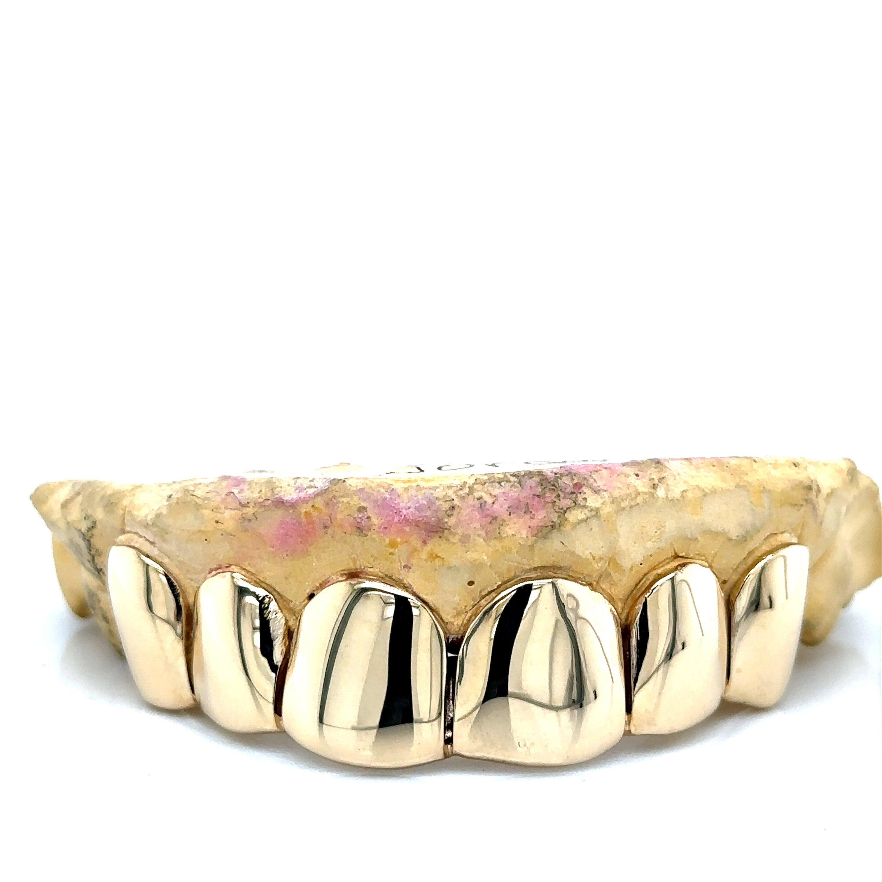 6pc Gold Perm Cut Top Grillz