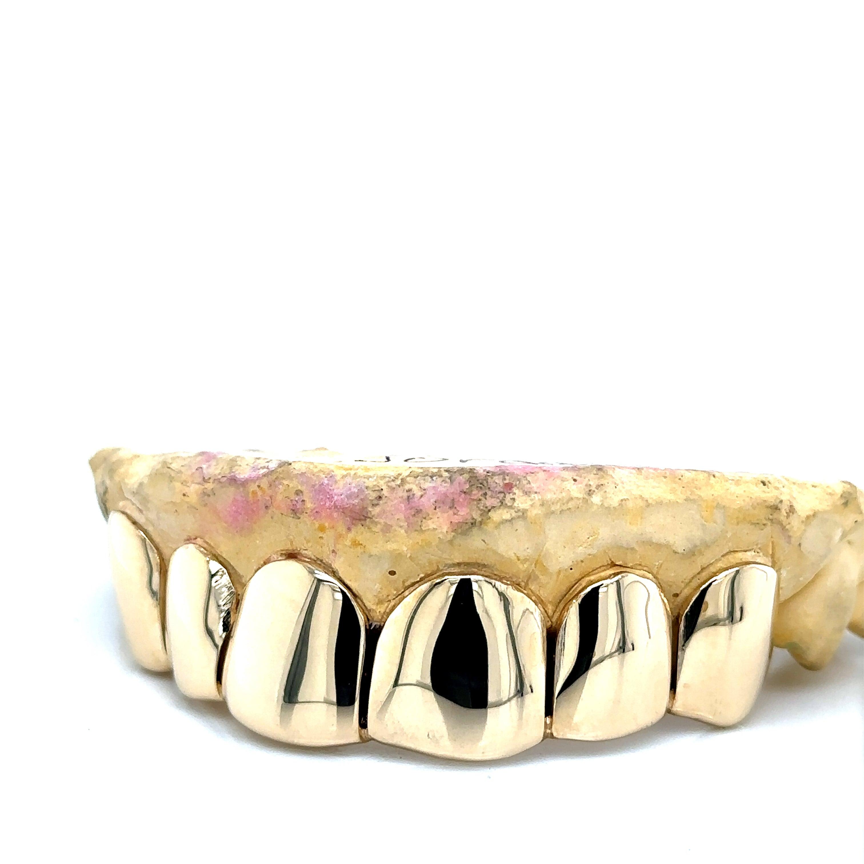 6pc Gold Perm Cut Top Grillz