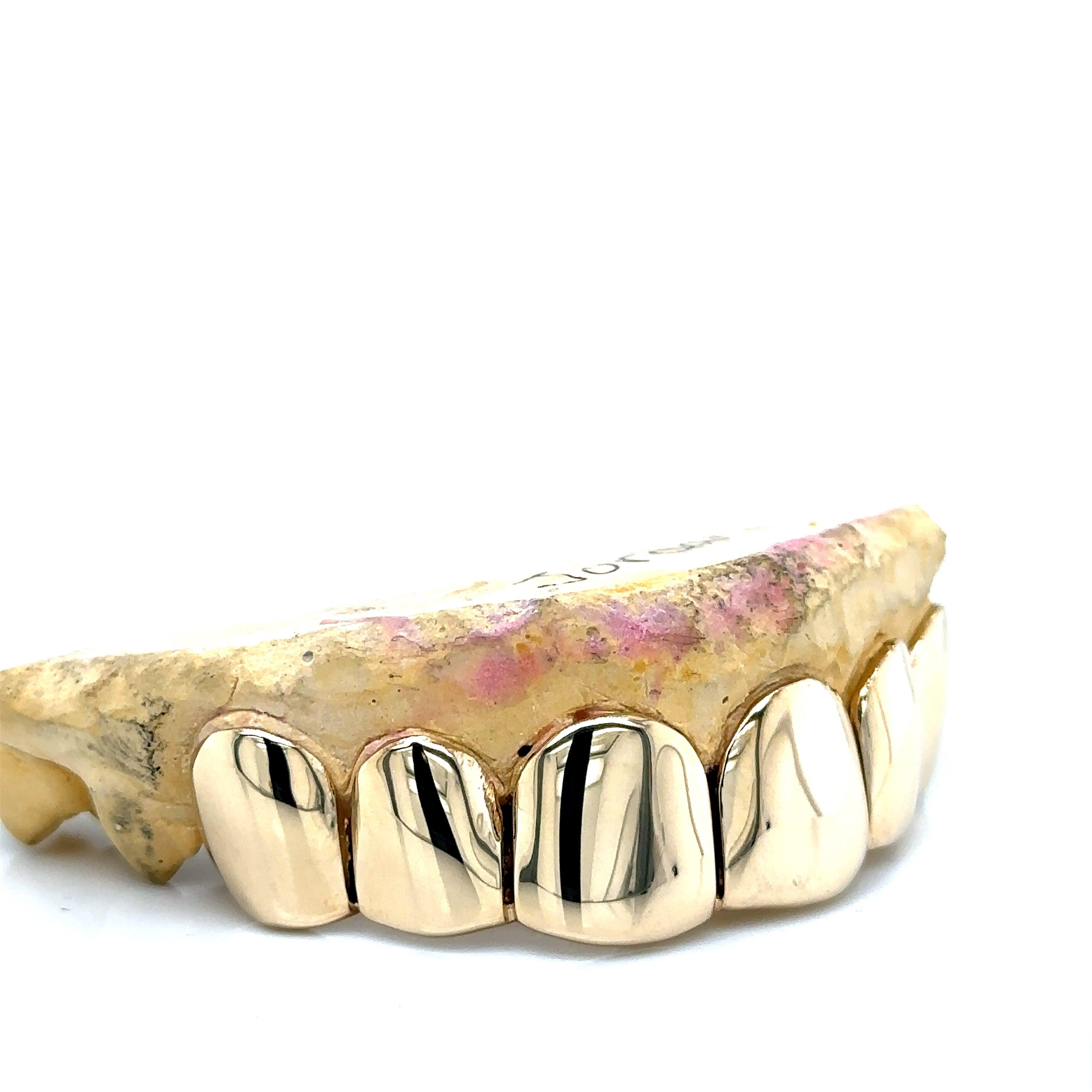 6pc Gold Perm Cut Top Grillz