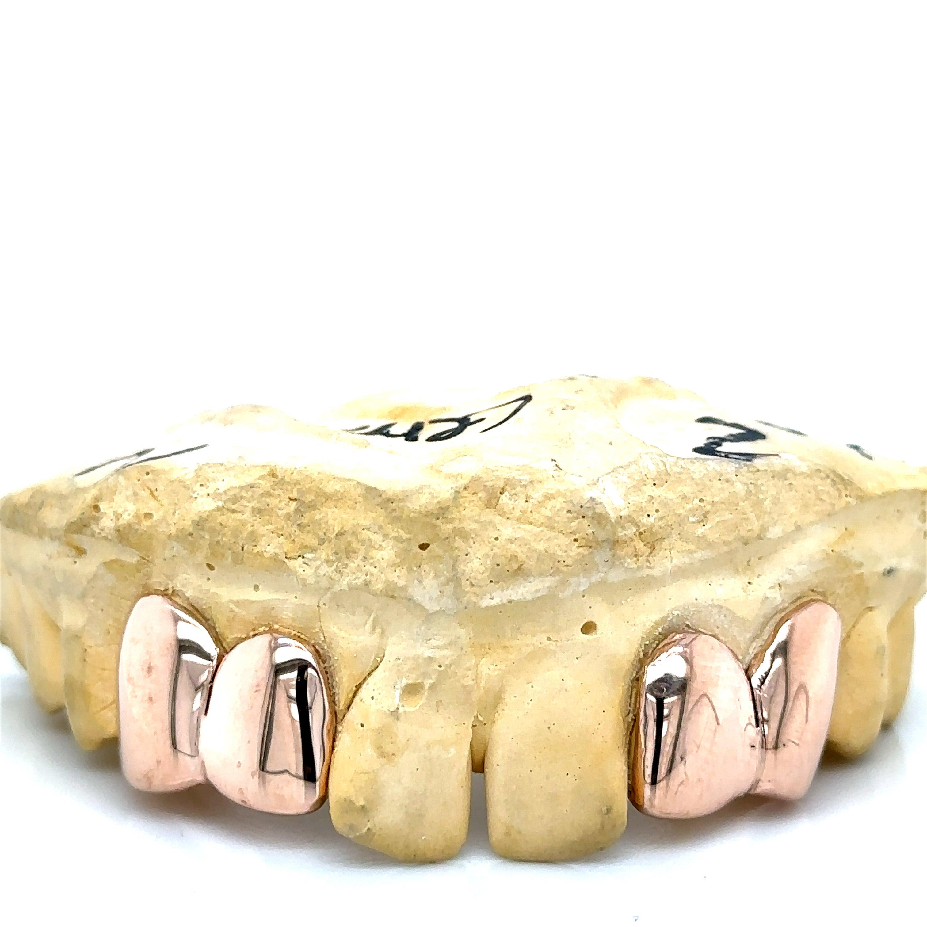 4pc Rose Gold Incisor Fang Top Grillz