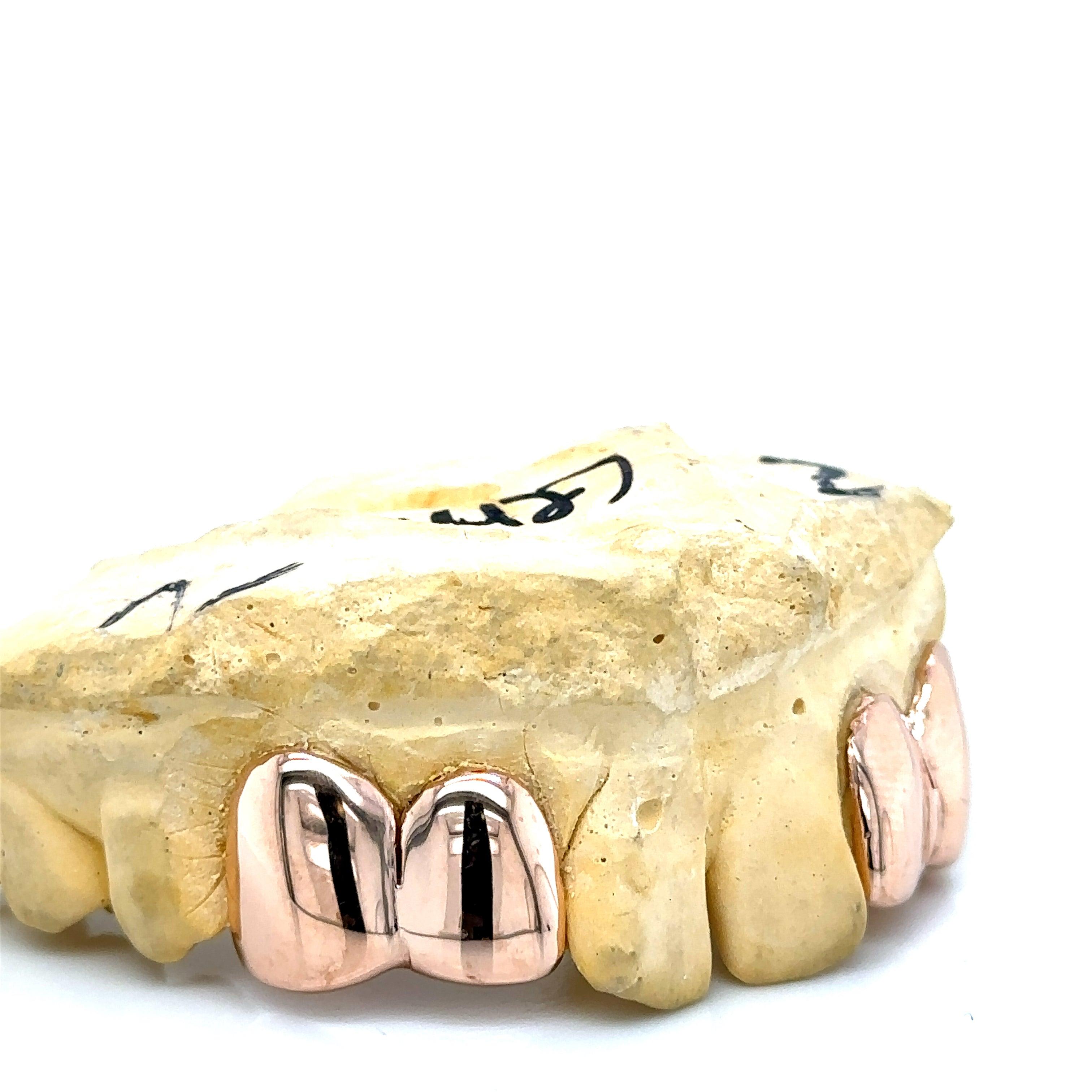 4pc Rose Gold Incisor Fang Top Grillz