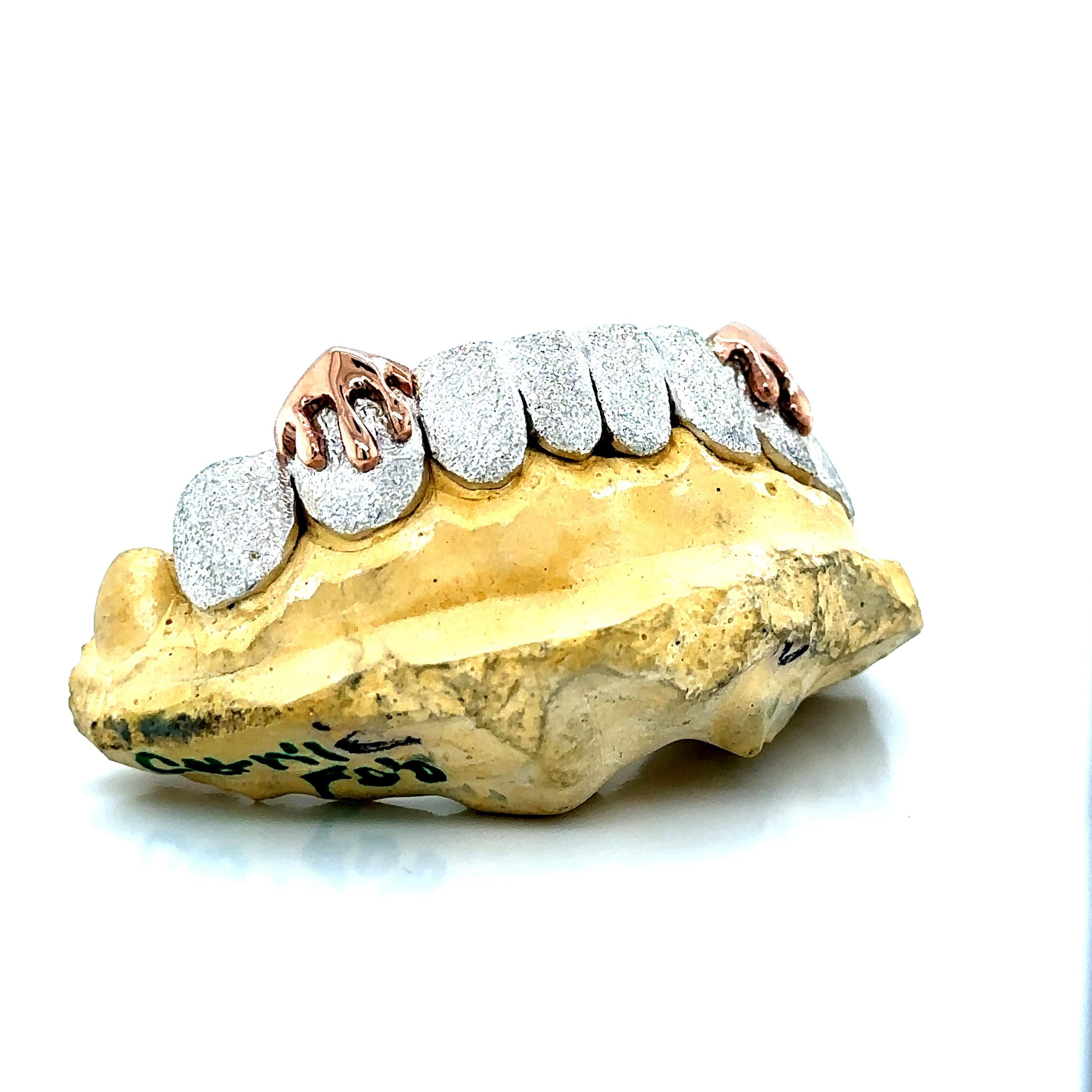 8pc Silver Diamond Dust Rose Gold Drip Bottom Grillz