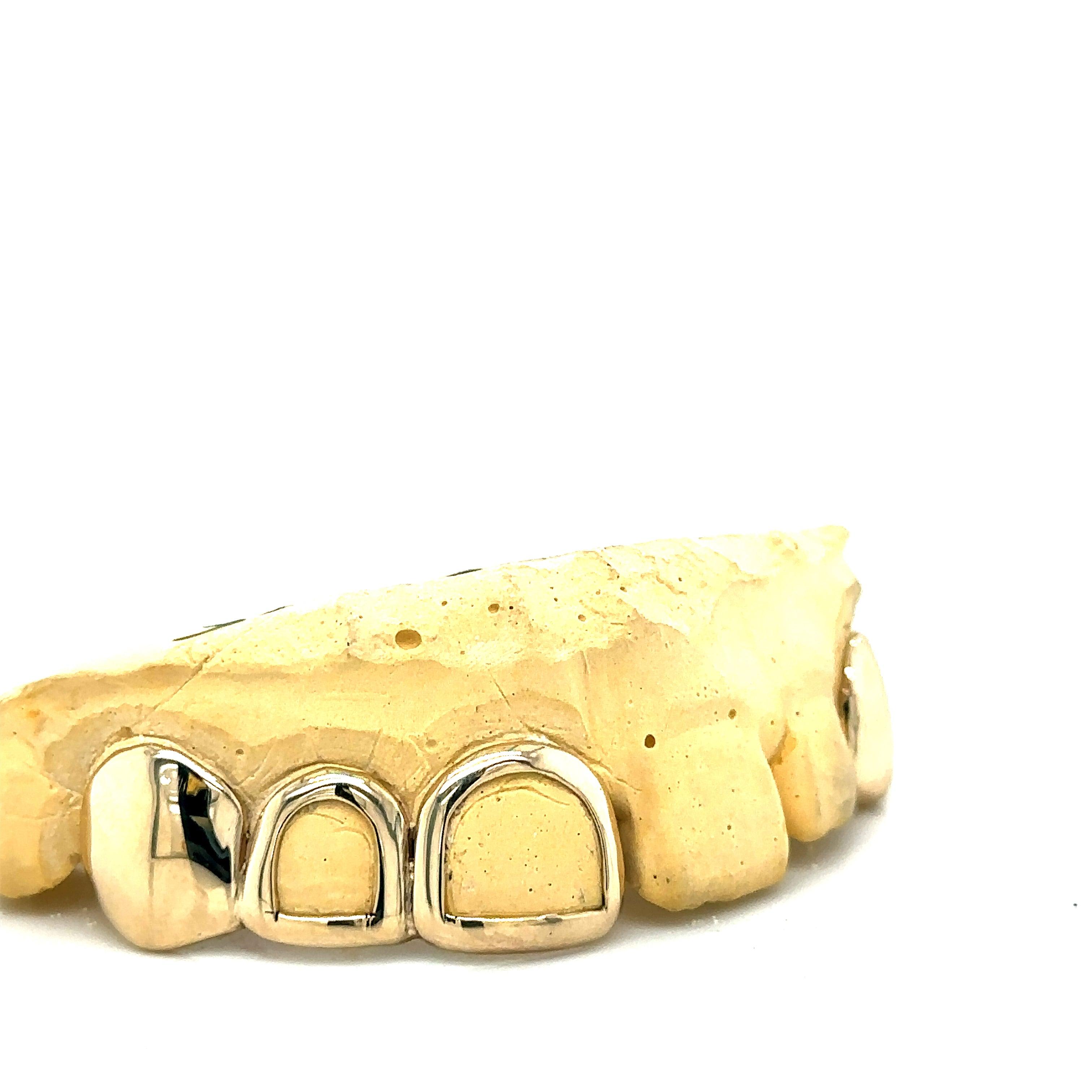 4pc Gold Open Face Top Grillz