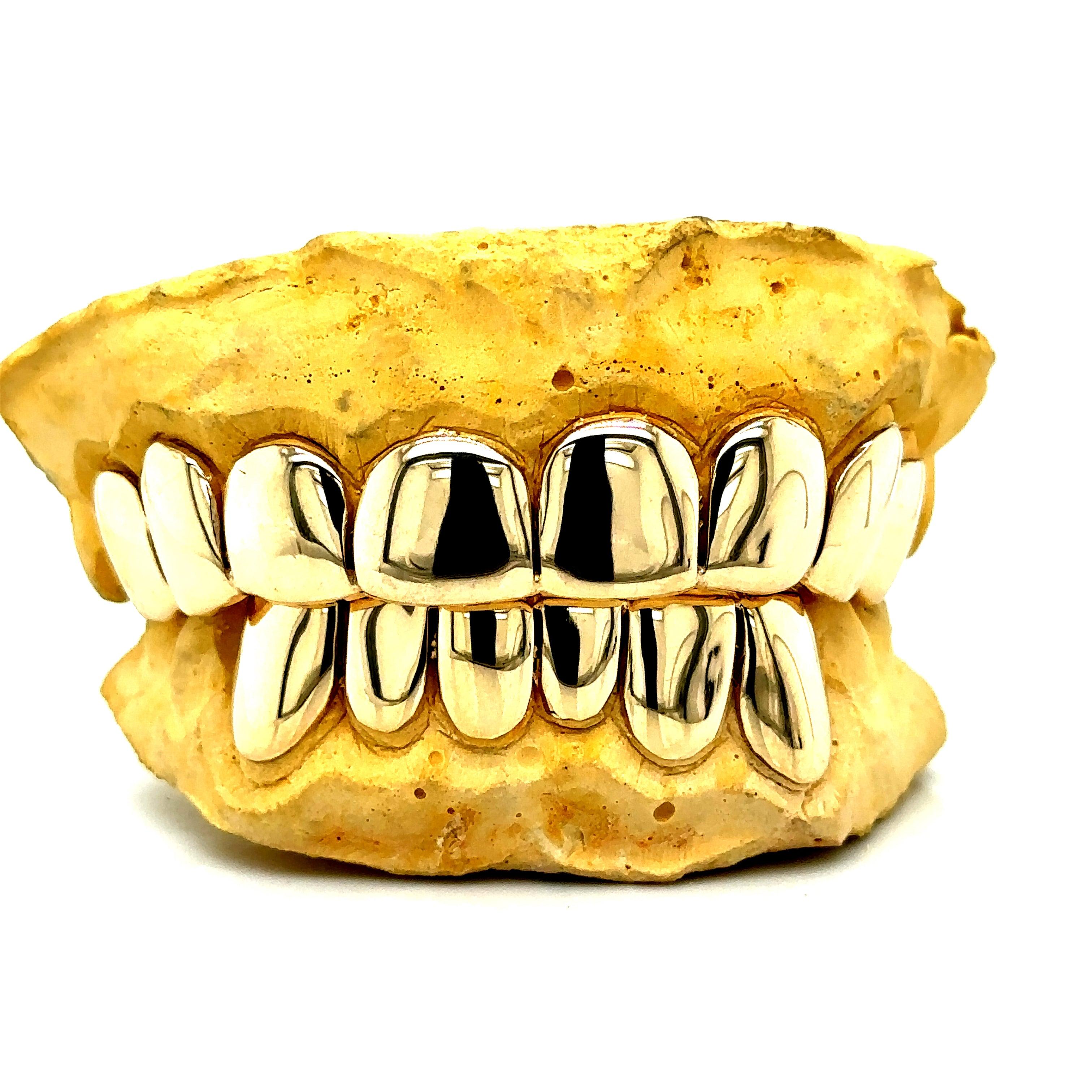 14pc Gold Perm Cut Grillz