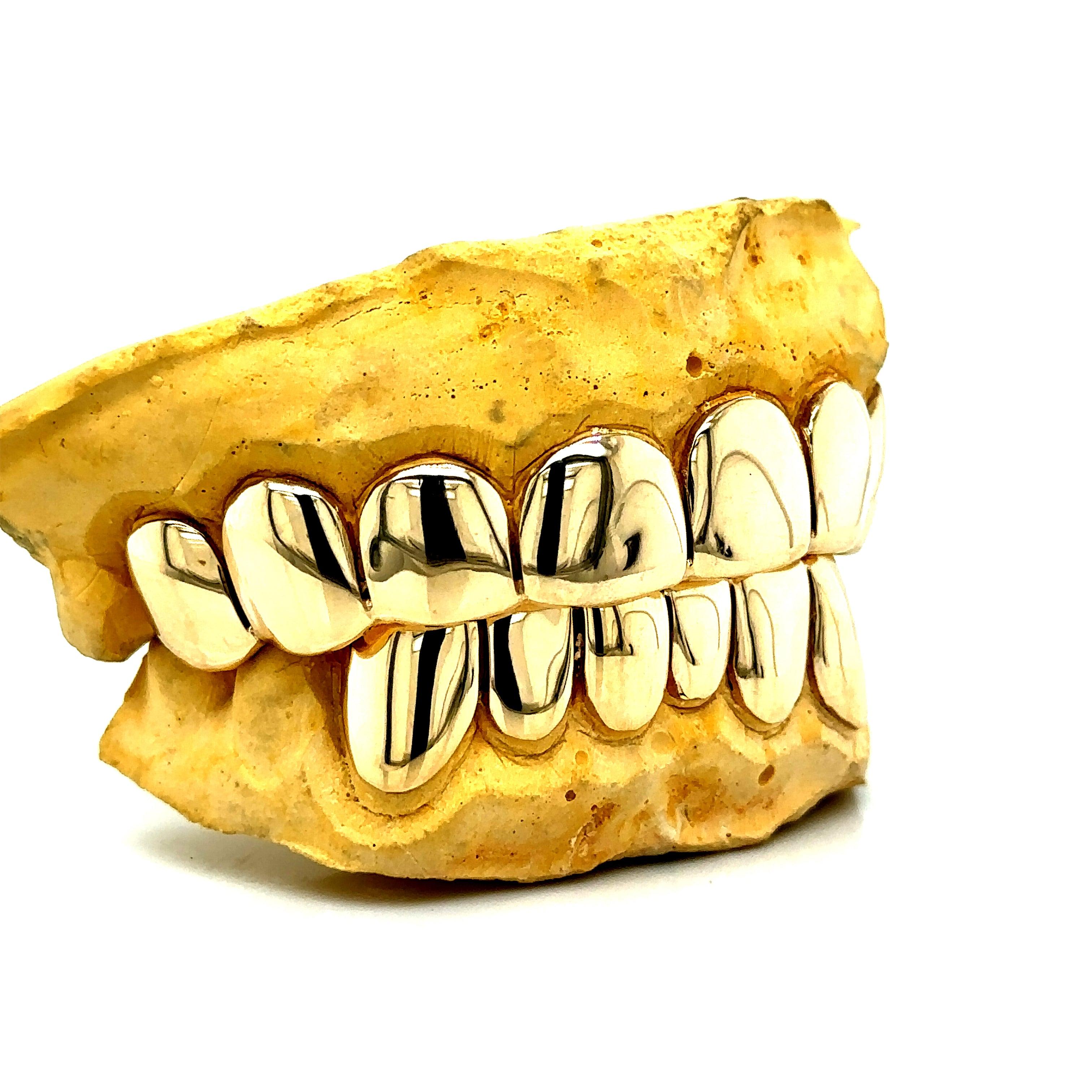 14pc Gold Perm Cut Grillz