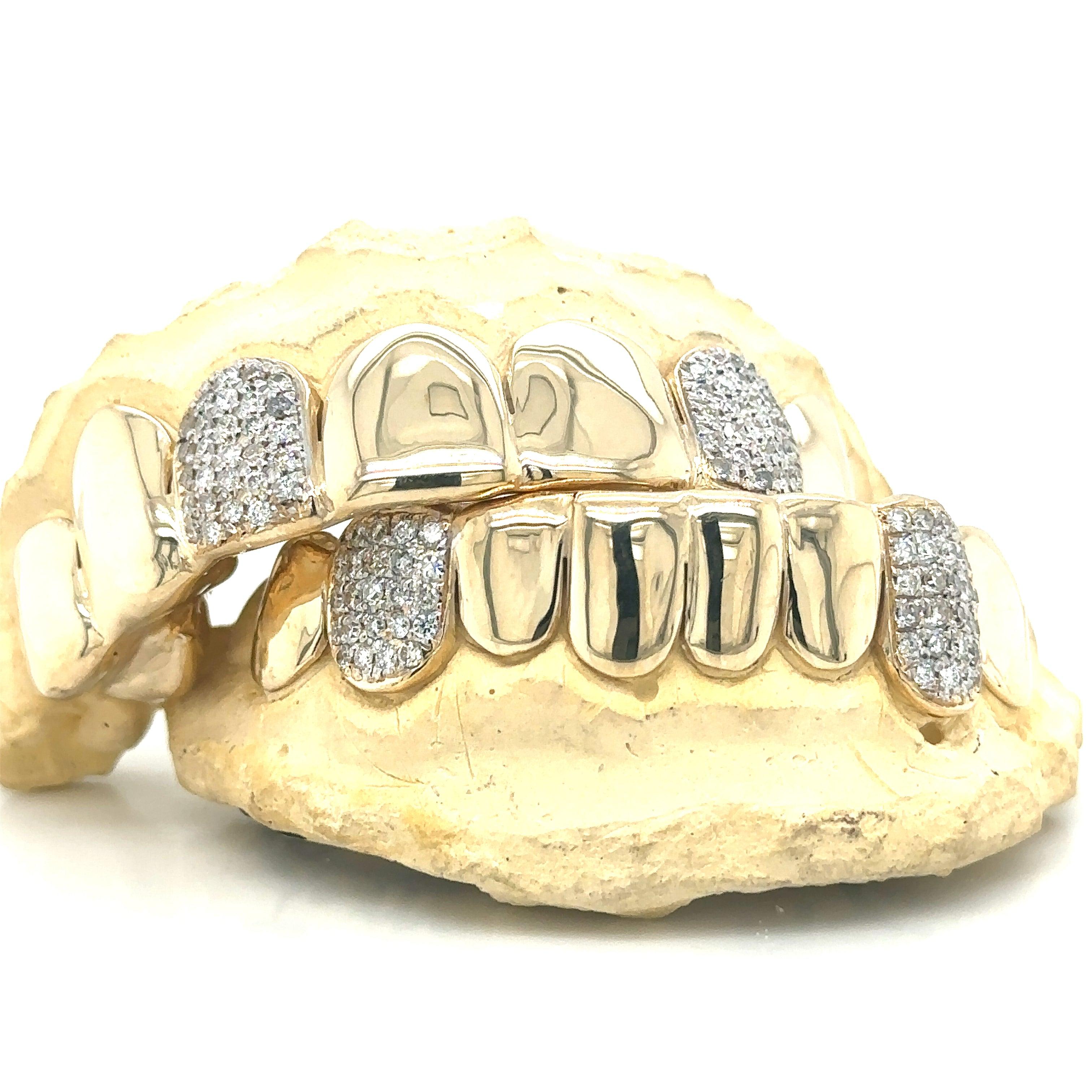 16pc Gold Diamond Teeth Grillz