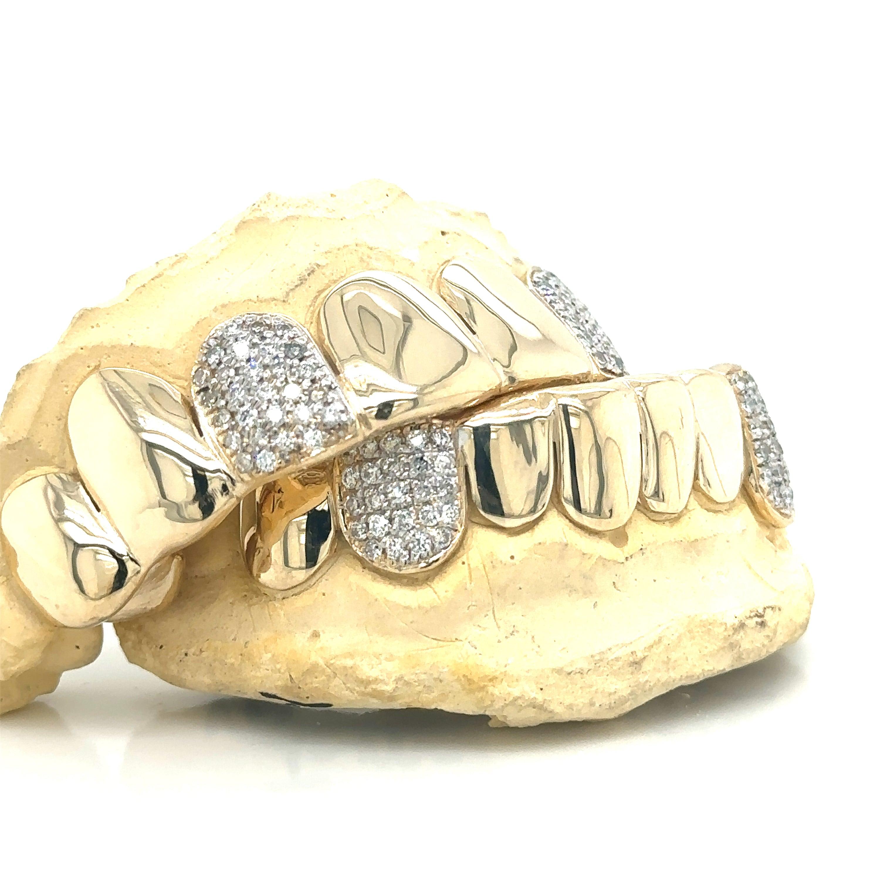 16pc Gold Diamond Teeth Grillz