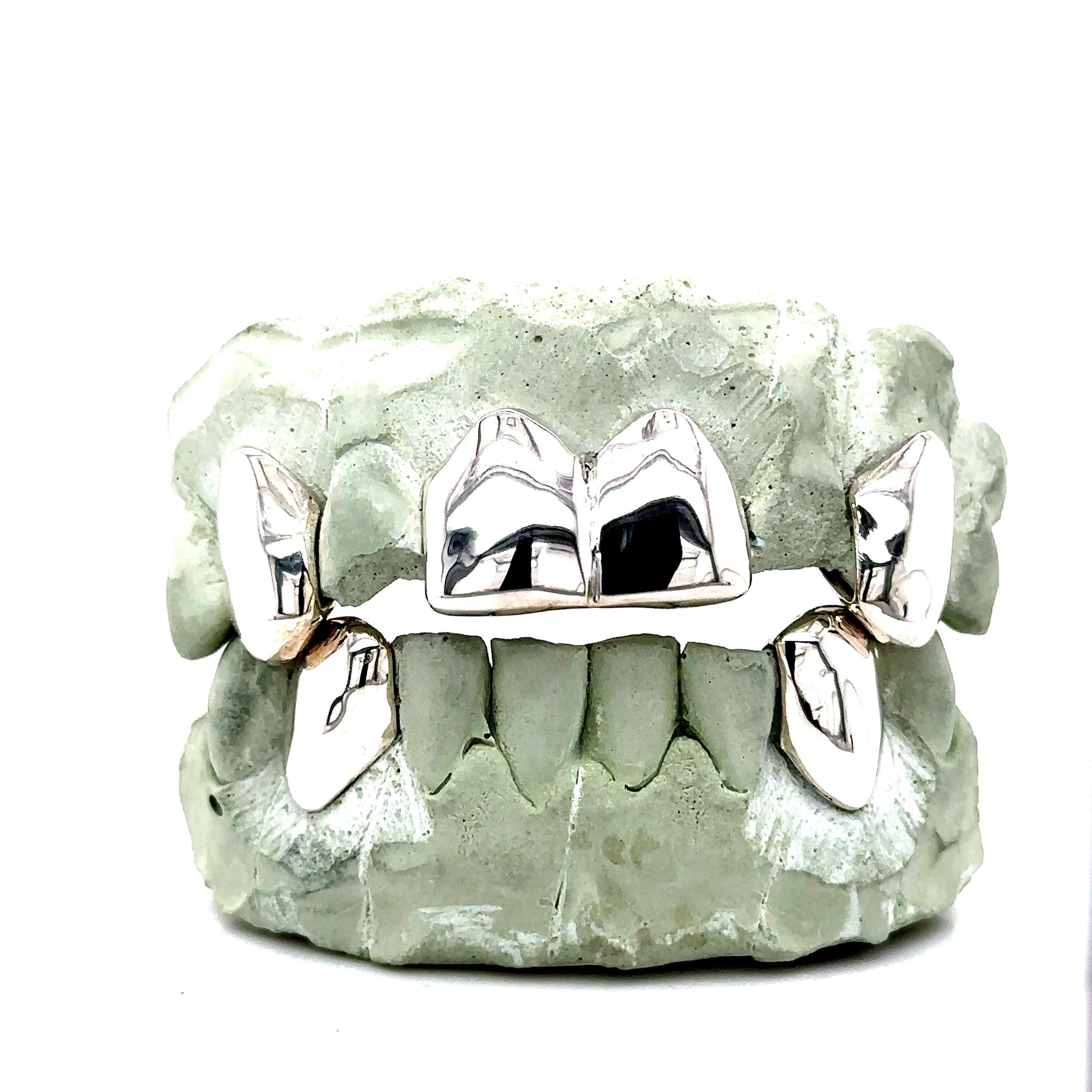 4 top 2 bottom Silver Grillz