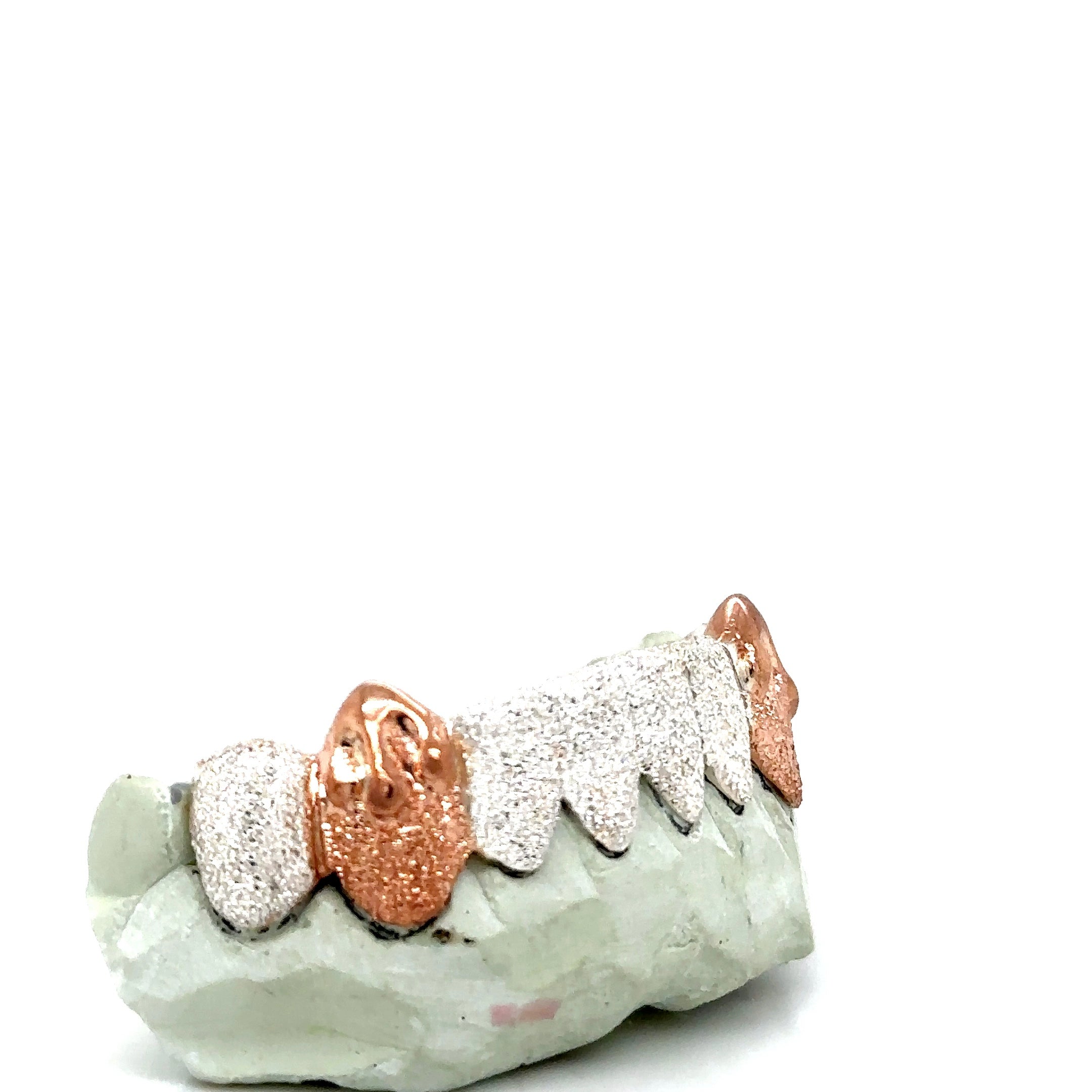 8pc Silver Diamond Dust Rose Gold Drip Bottom Grillz