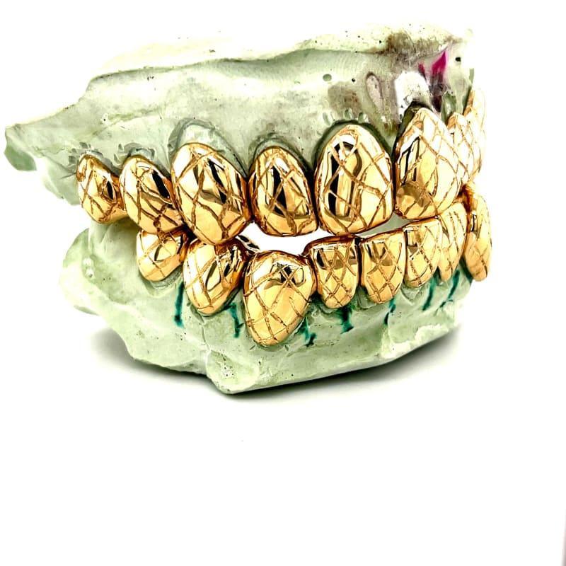 20pc Gold Cracked Egg Grillz - Seattle Gold Grillz