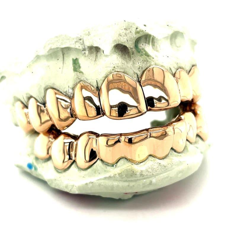 20pc Gold Perm Cut Grillz - Seattle Gold Grillz