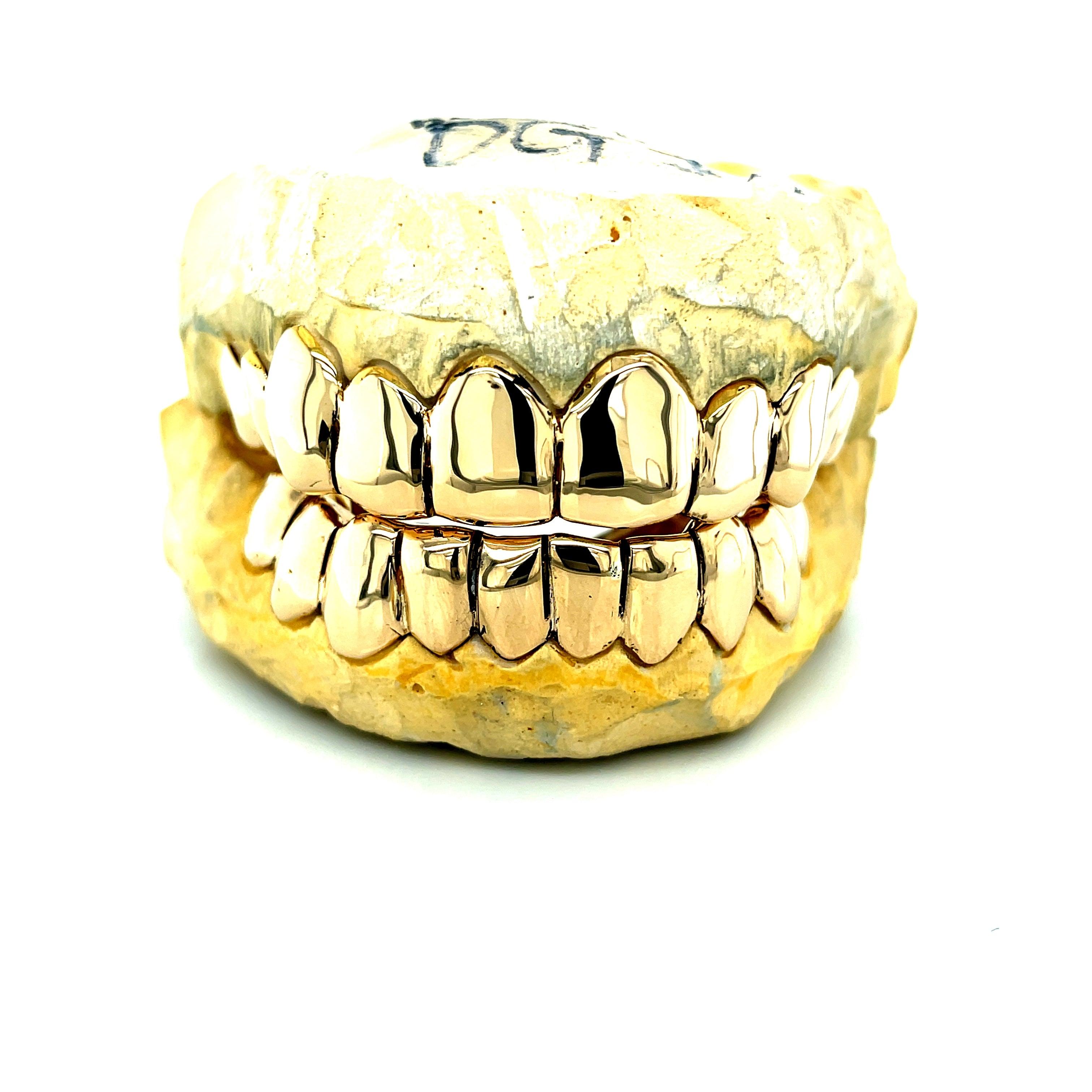 20pc Gold Perm Cut Grillz - Seattle Gold Grillz